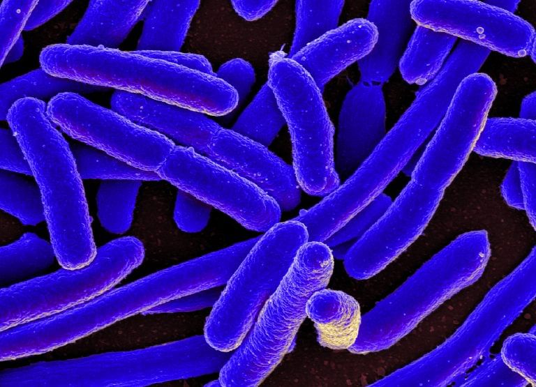 Scientists get glimpse of life 3.4 billion years ago. It’s likely the oldest we have yet