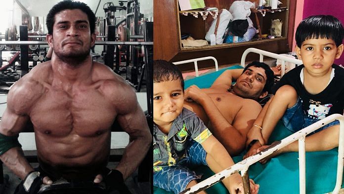 Jitender Yadav before (left) and after being shot and paralysed
