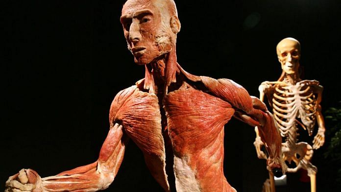 Plastified human body specimen