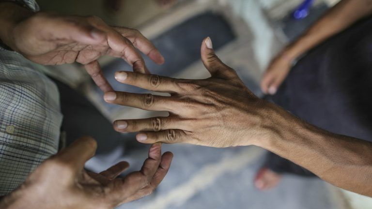 After 36 years of testing, Indian-made leprosy vaccine finally set for large roll-out