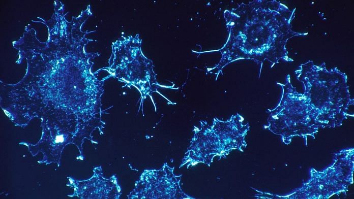 Scan of cancer cells | Representational image | pixabay.com