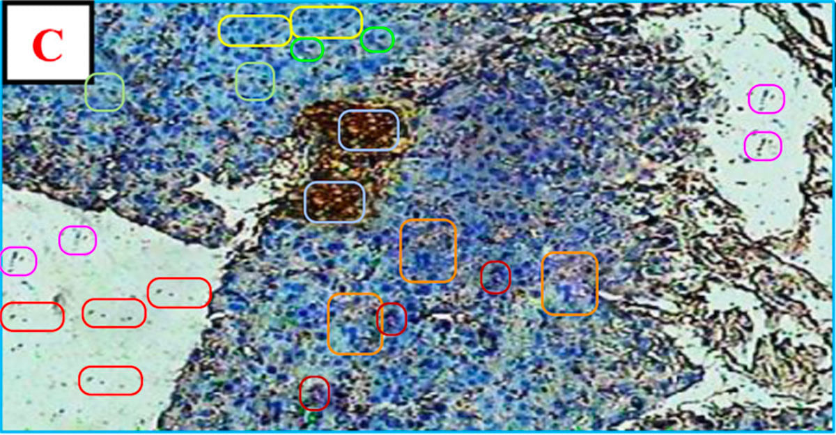 Supposed image of pancreatic tissue from diabetic rats showing duplication of patterns as marked by Bik | Credit: Elisabeth M. Bik | Original image: Rafeek Hidhayath Basha and Chandrasekaran Sankaranarayanan, Annamalai University