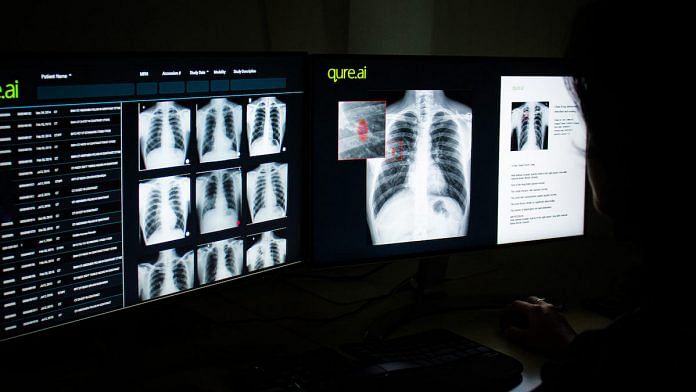 Qure.ai's X-ray technology can help identify patients who may have Covid-19 | Photo: By special arrangement