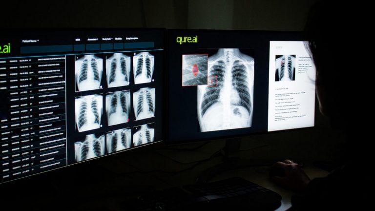 Magic glue to heal broken bones? Chinese scientists’ ‘3-minute’ fix