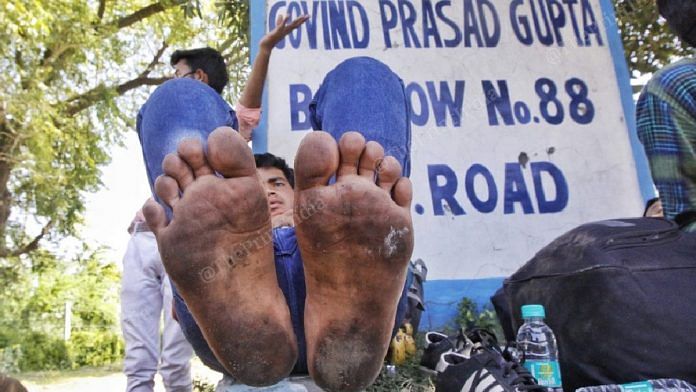 Migrant labourer Arif Khan shows the blisters on his feet in Agra | Photo: Praveen Jain | ThePrint