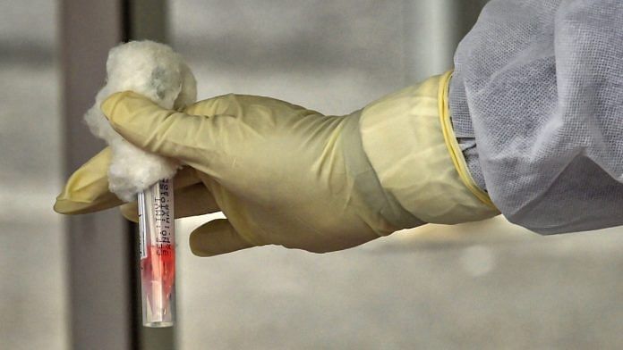 A medic works on Covid-19 samples (representational image) | Photo: PTI