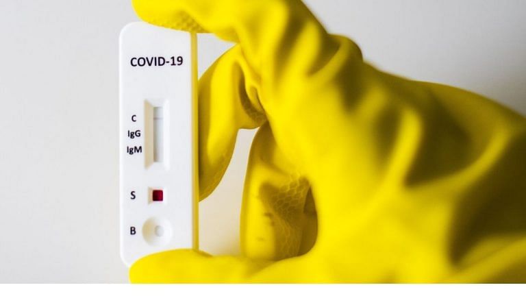Why mass coronavirus anti-body tests have serious limits