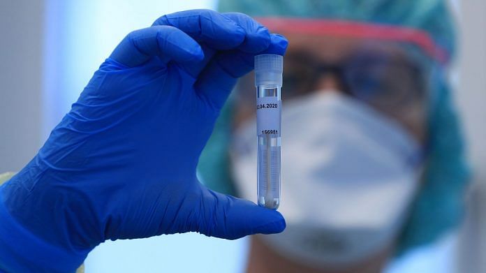 A doctor wearing personal protective equipment (PPE) holds a saliva swab in a test tube during coronavirus symptom tests | Representational Image | Photographer: Krisztian Bocsi | Bloomberg