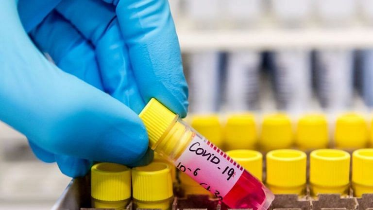 Reproduction rate is the coronavirus number that is worth watching
