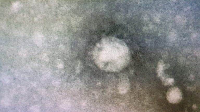 We built a map on how coronavirus use human cells to spread. It is very similar to cancer