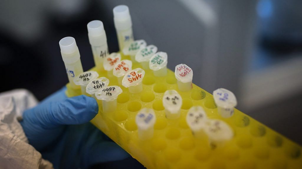 A laboratory technician collects vials of patient swabs during coronavirus detection testing at a laboratory