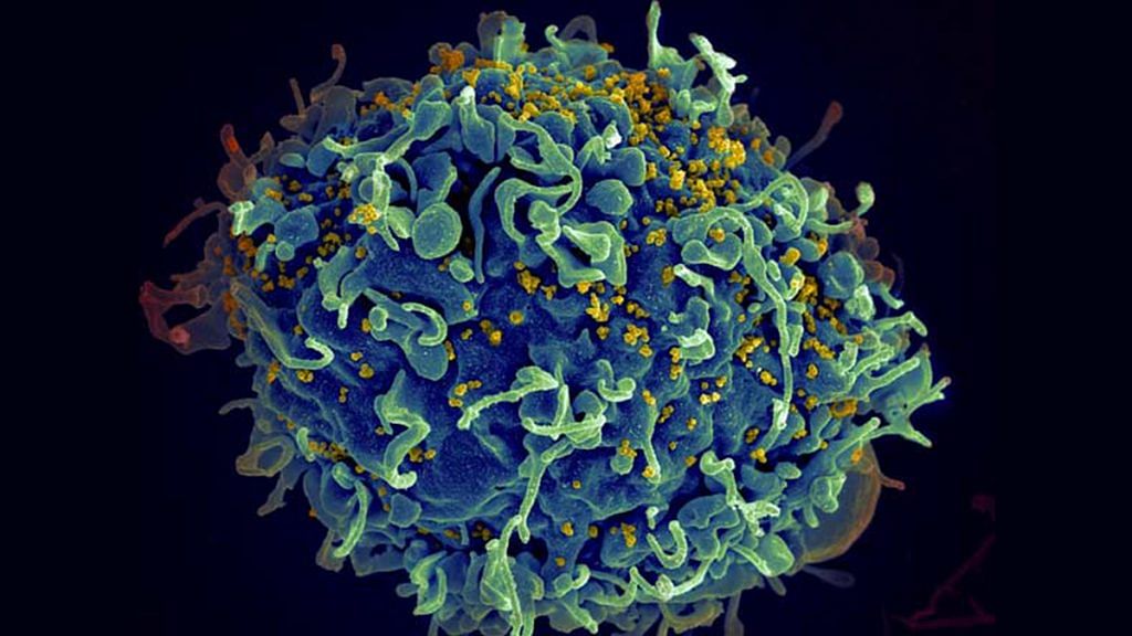 Human T cell (blue) under attack by HIV (yellow), the virus that causes AIDS | Credits: www.nih.gov