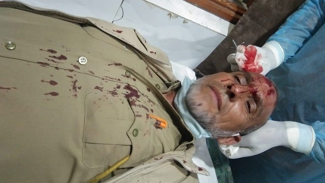 One of the policemen injured in the clashes Sunday | By special arrangement