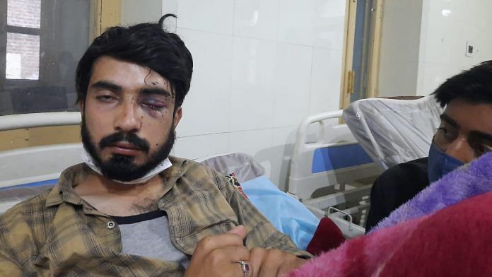 Suhail Abbas (19) was among those brought to the SMHS Hospital in Srinagar with pellet injuries | Photo: Azaan Javaid | ThePrint
