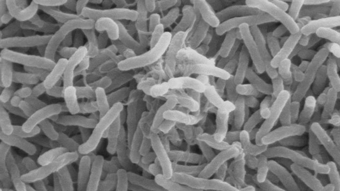 Vibrio cholerae bacteria | Wikimedia Commons