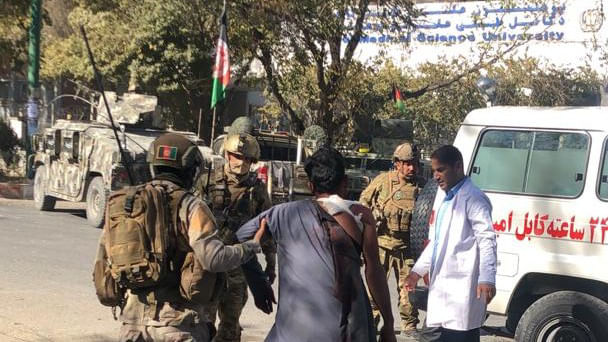 A person injured during the attack on Kabul University campus on 2 November