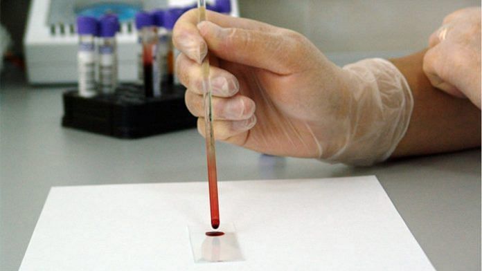 A blood test (representative image) | Pixabay