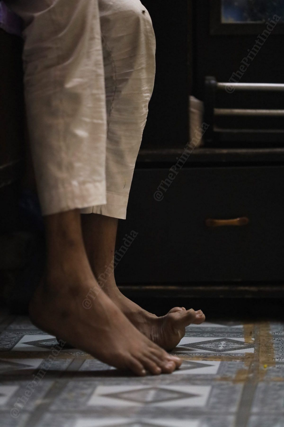 Faizan faces difficulty keeping his feet on the floor evenly | Photo: Manisha Mondal | ThePrint