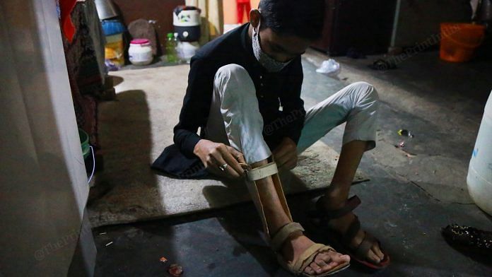 Faizan wears a cast to support his right foot | Photo: Manisha Mondal | ThePrint