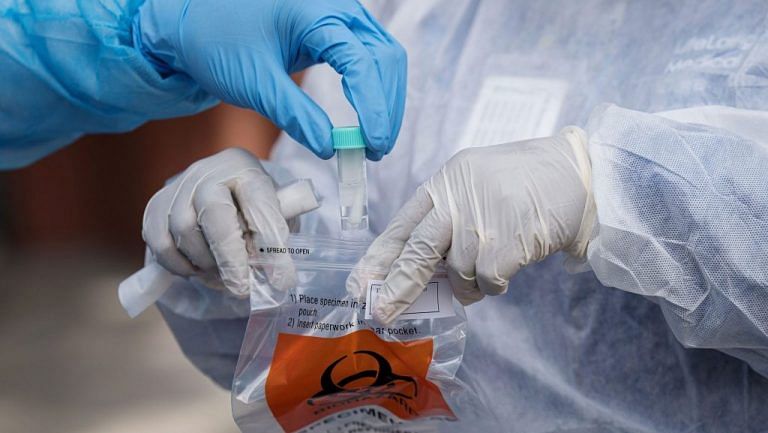 Some Covid long-haulers are baffling doctors with symptoms that go on and on