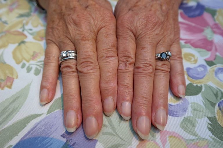Covid nails — These changes to your fingernails can show if you’ve had coronavirus