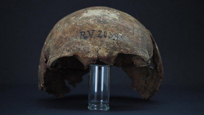 the skull bones of the man buried in Riukalns, Latvia, around 5,000 years ago | Credits: Dominik Göldner, BGAEU, Berlin