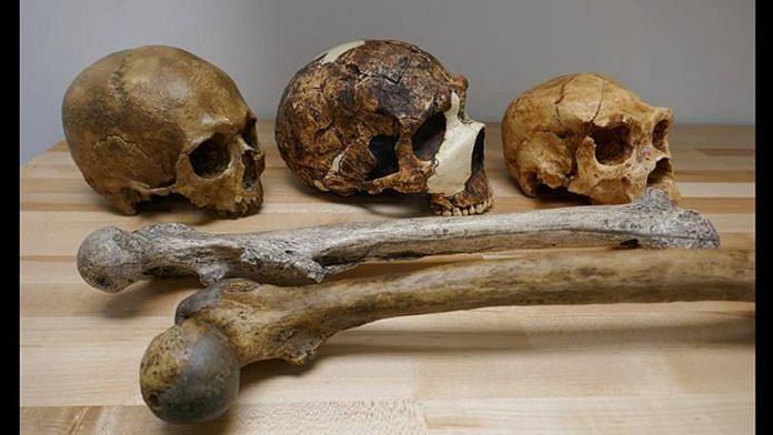 Human skull remains | University of Cambridge