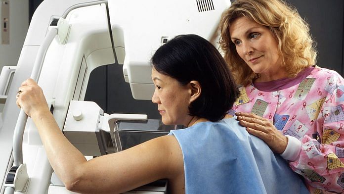 Representational image | A woman undergoes a mammogram to screen for breast cancer | Wikimedia commons