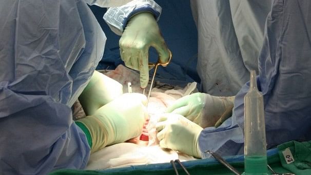 Representational image of an organ transplant surgery