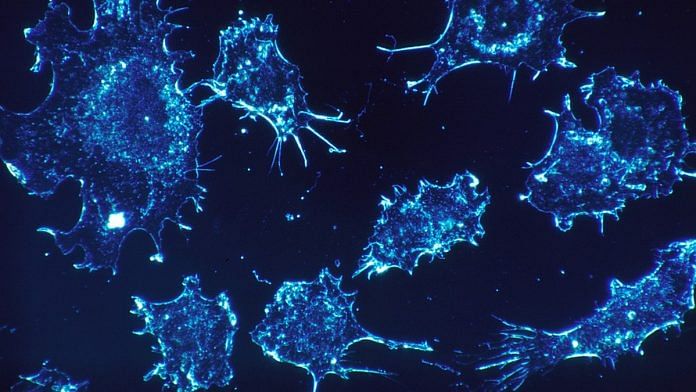 Cancer cells | Representational image | Pixabay