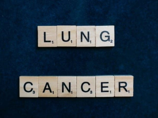 Scientists develop model to predict patients with poor lung cancer outcomes