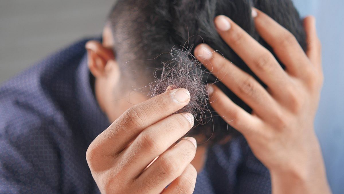 Thinning hair Causes types treatment and remedies