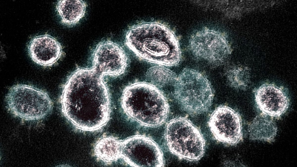This transmission electron microscope image shows SARS-CoV-2, the virus that causes Covid | Photographer: BSIP/IMAGE POINT FR/NIH/NIAID/BSIP/Universal Images Group/Getty Images via Bloomberg This transmission electron microscope image shows SARS-CoV-2, the virus that causes Covid | Photographer: BSIP/IMAGE POINT FR/NIH/NIAID/BSIP/Universal Images Group/Getty Images via Bloomberg