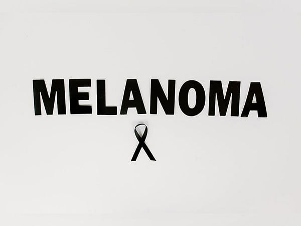 Researchers find molecular factors to treat melanoma skin cancer