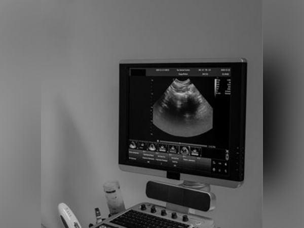 Study finds human fetuses evolved to slow shoulder growth for easier delivery