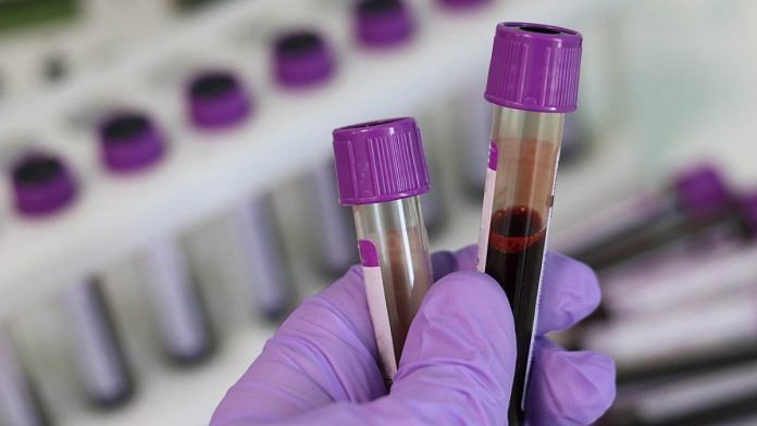 Representational photo of testing at medical labs | Pixabay