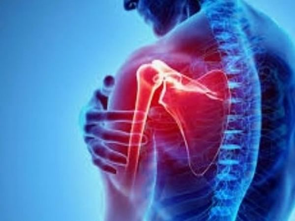 Study shows benefits of amputation for patients with severe brachial plexus injuries