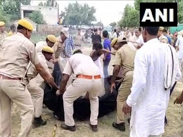Condition of Sadhu who attempted self-immolation in Rajasthan's Deeg stable says official