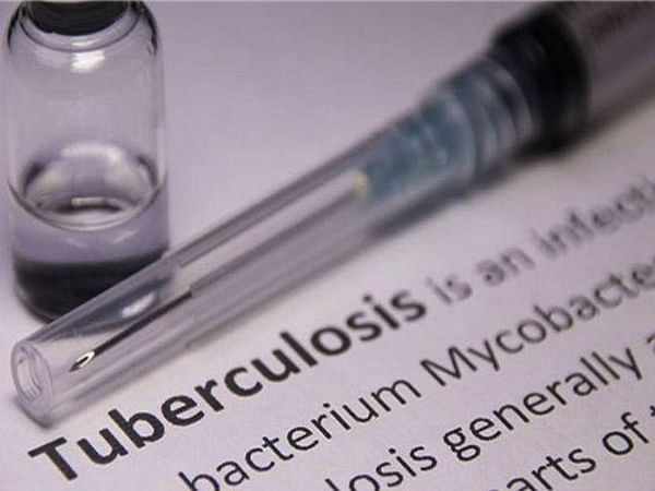 Researchers find new effective therapeutic approaches to treat tuberculosis