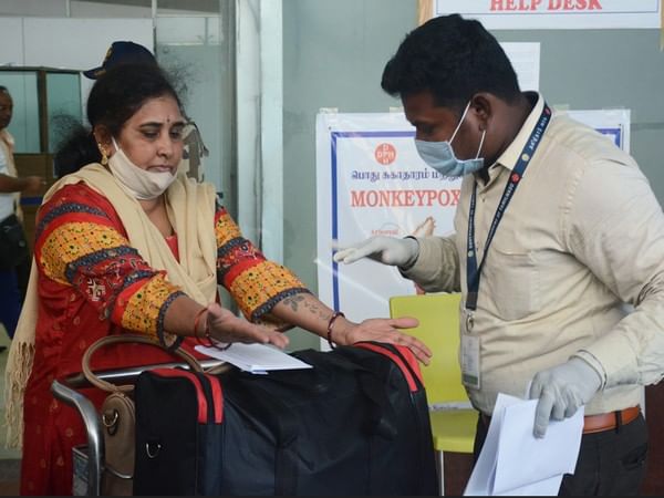 5 things you need to know about Monkeypox- Here's what experts have to say