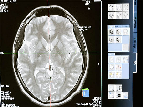 Virologists identify better model to examine brain-attacking viruses