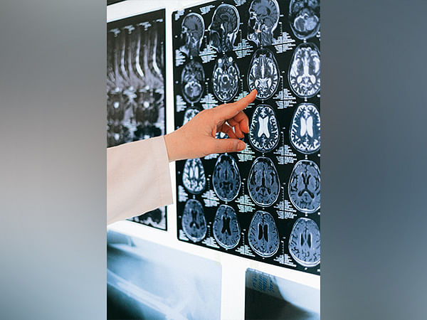 Human brain's cerebral cortex mapped by scientists