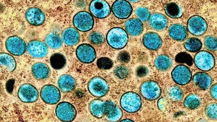 Colorised transmission electron micrograph of monkeypox virus particles | Representational image | Flickr