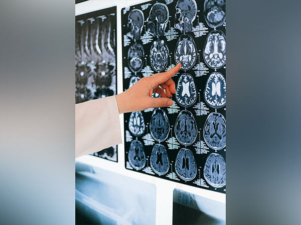 Study: AI-enhanced advancements in dynamic brain imagingStudy: AI-enhanced advancements in dynamic brain imaging