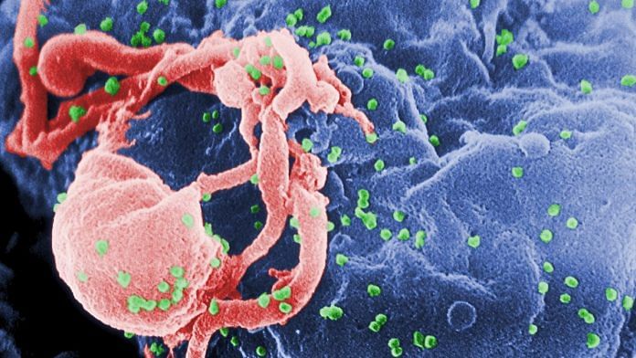 A scanning electron micrograph of HIV-1 budding from cultured lymphocyte | Representational image | Wikipedia