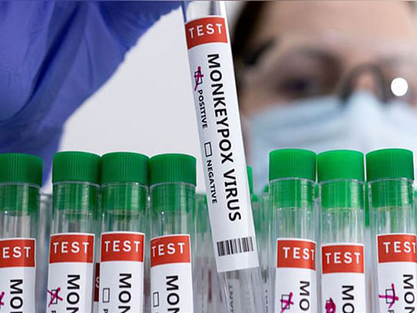 ICMR NIV Pune, VRDLs conduct approx 100 sample tests for Monkeypox 