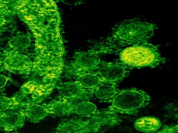 Study finds how highly resistant strains of fungi emerge