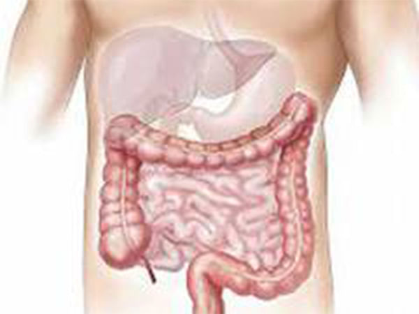 Study probes how intestine repairs damaged tissue