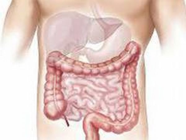 Study finds intestinal immune cells have sweet tooth