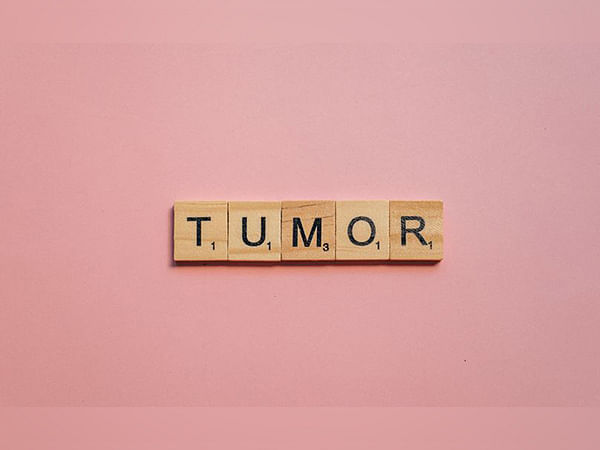 Scientists discover new device to measure changing size of tumors below skin